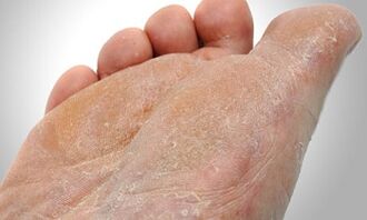 Percorsi di trasmissione dei funghi del piede